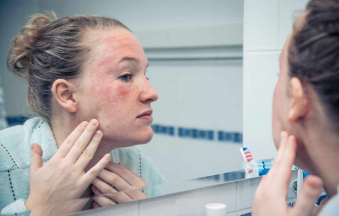 How Nourishing Milk Cleansers Solve Redness in Sensitive Skin - SIMCO SKINCARE